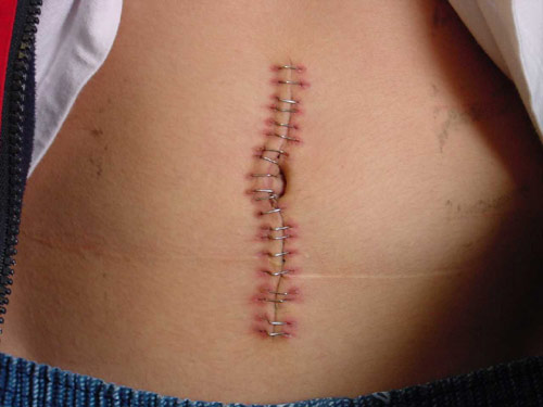 Holding In My Guts (South&nbsp;Africa)